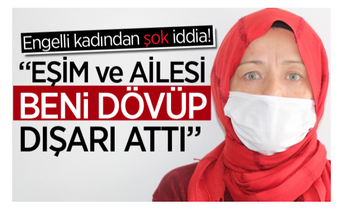 Şok iddia! "Eşim ve ailesi beni dövdü"