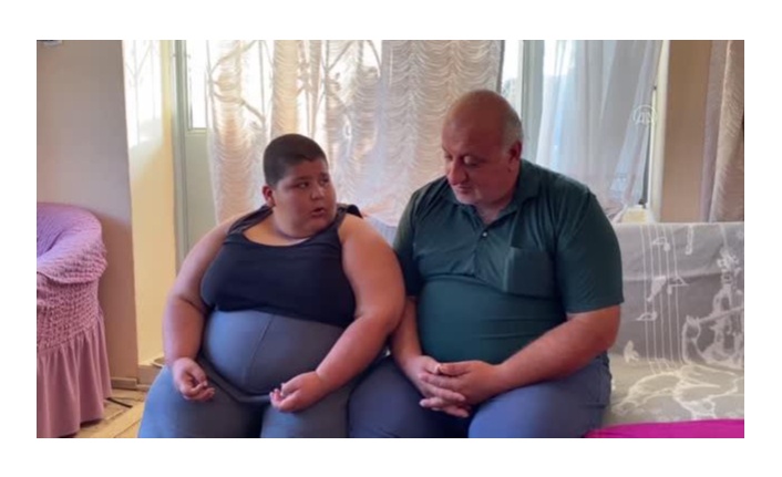 Küçük Efe, obeziteden kurtulabilmek için destek bekliyor