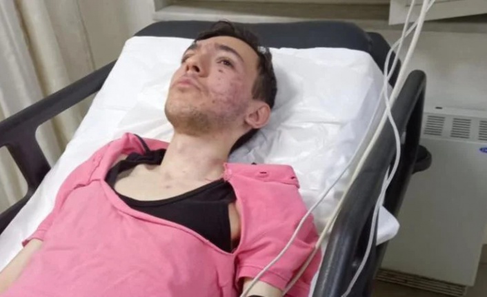 Zihinsel engelli Arlen, sokak ortasında dakikalarca şiddet gördü
