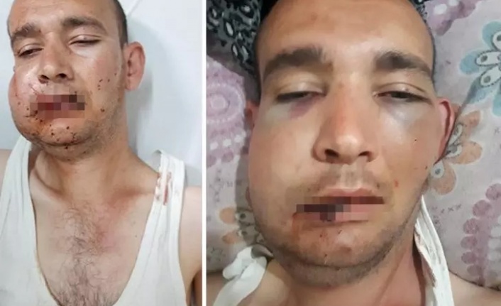 Kas hastası genci döverek hastanelik etti! Sebebi 'pes' dedirtti