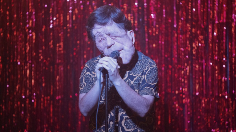 Adam Pearson 'Fil Adam' rolünü üstlenen ilk engelli yıldız olacak