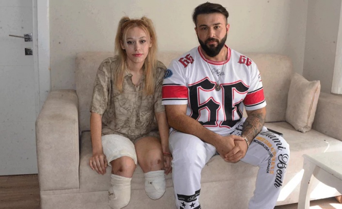 Evlilik yıl dönümünde bacaklarını kaybetti