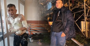 Engelli vatandaşa dehşeti yaşattı. Üzerine benzin döküp yakmış